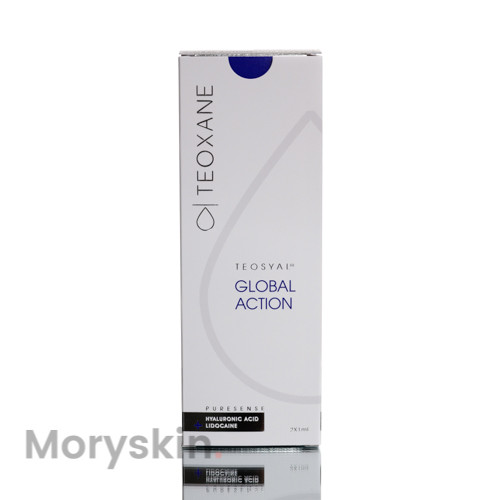 Teosyal ® PureSense Global Action